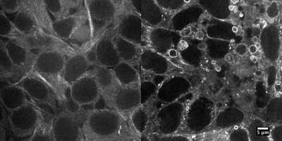 Cell line media
